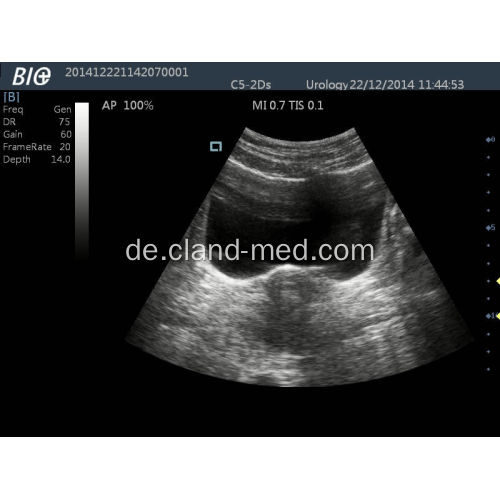 Tragbarer Ultraschall-Scanner-Digital-Ultraschallgerät-Preis